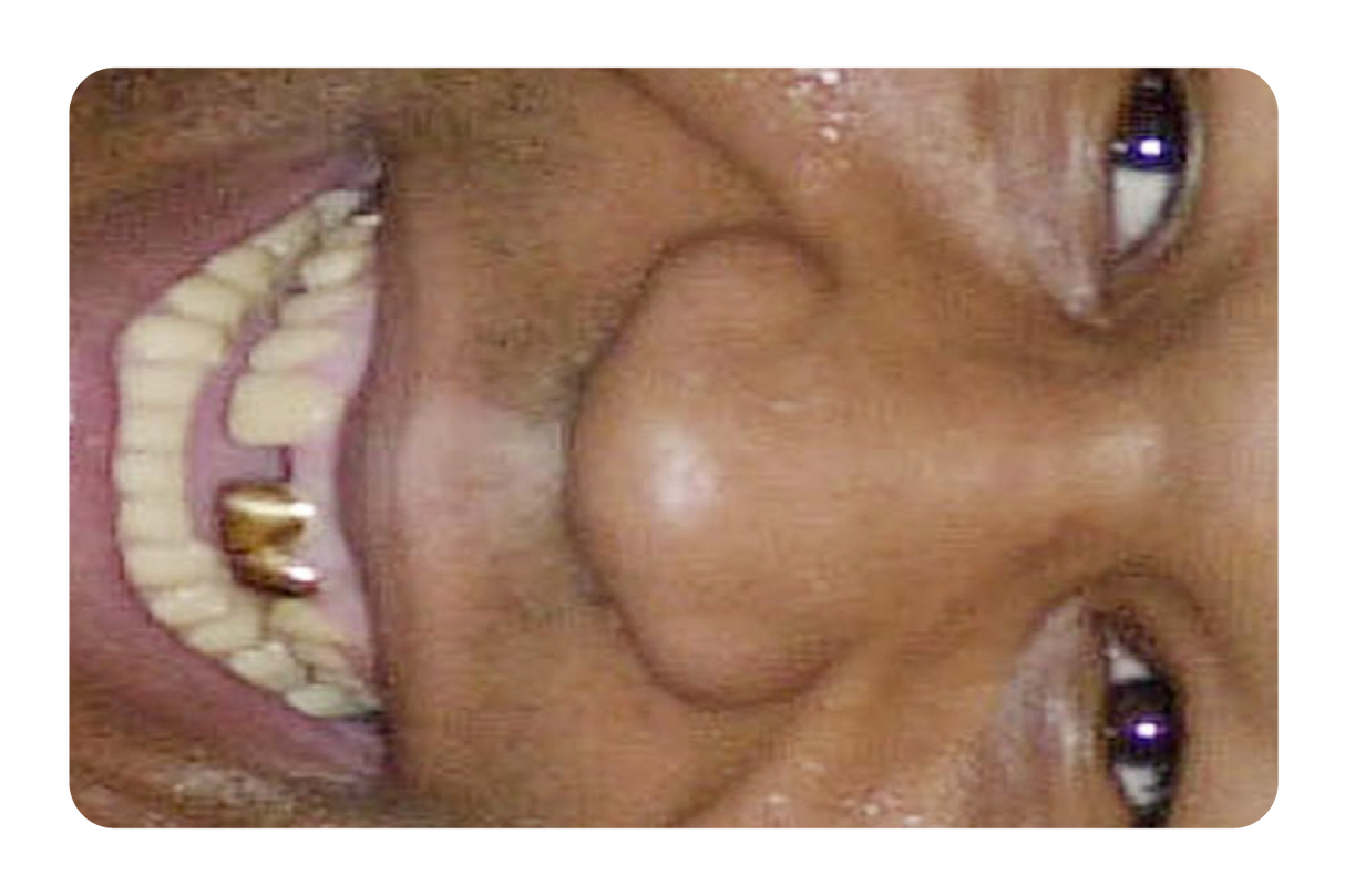 Tyson Grillz