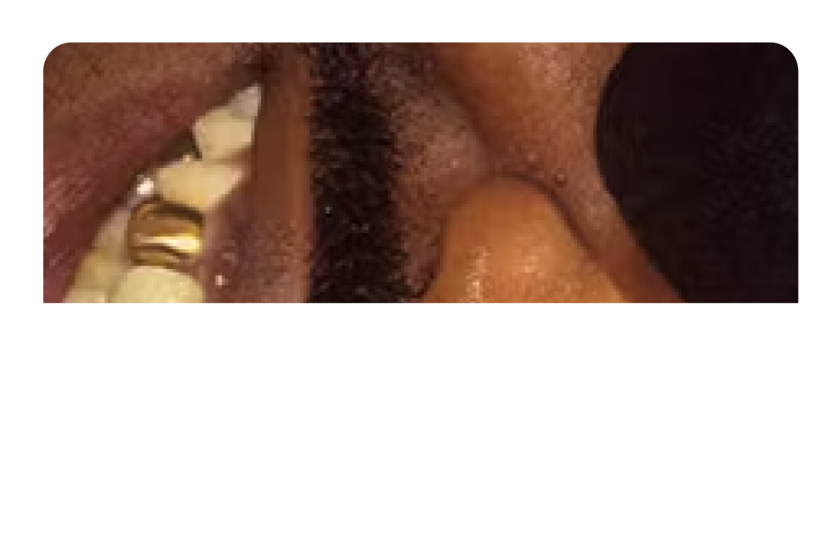 Slick Grillz