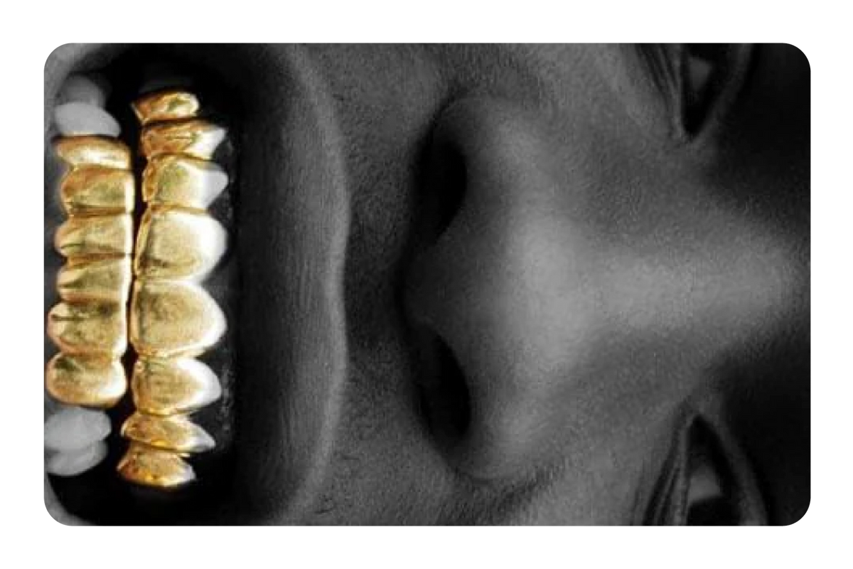 ASAP Grillz