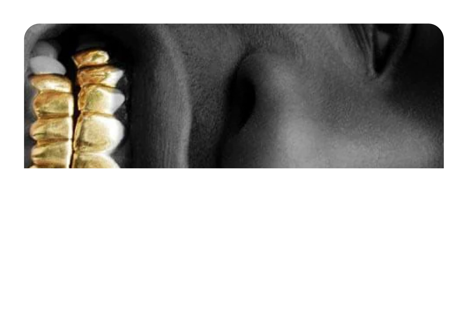 ASAP Grillz