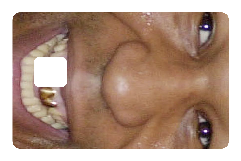 Tyson Grillz