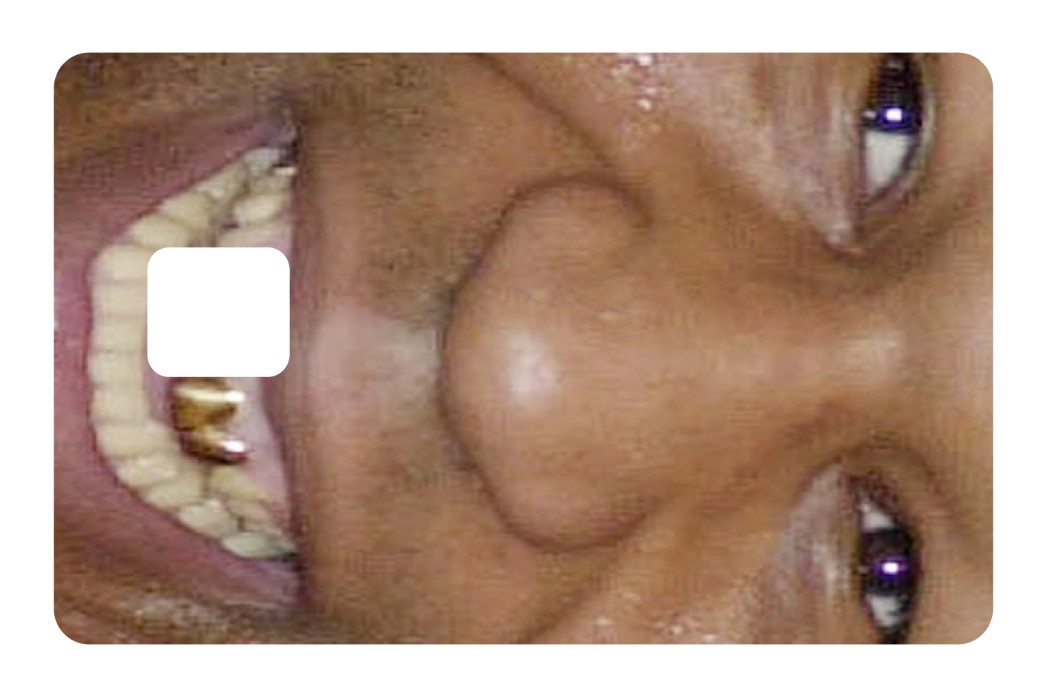 Tyson Grillz