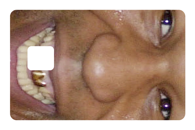 Tyson Grillz