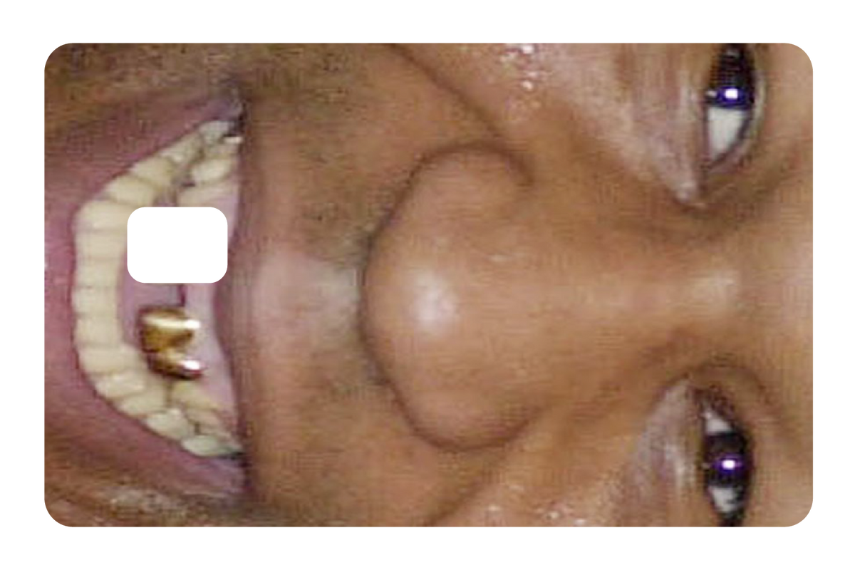 Tyson Grillz
