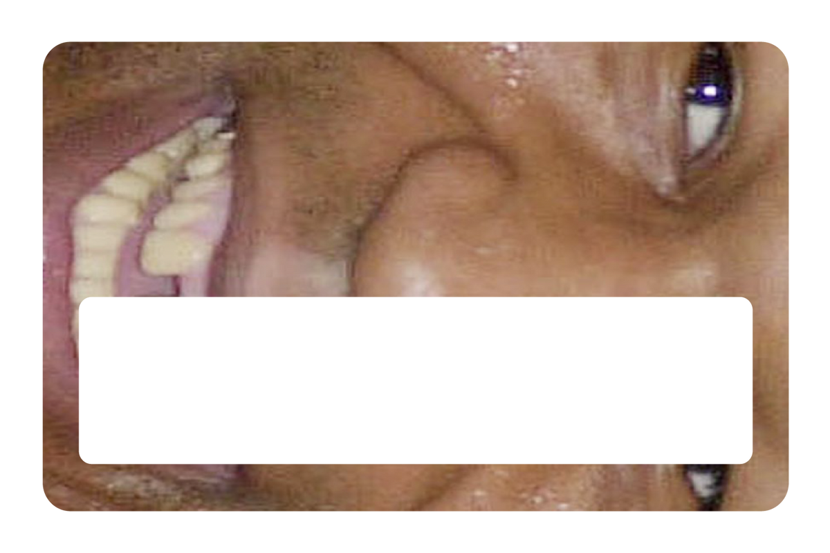 Tyson Grillz