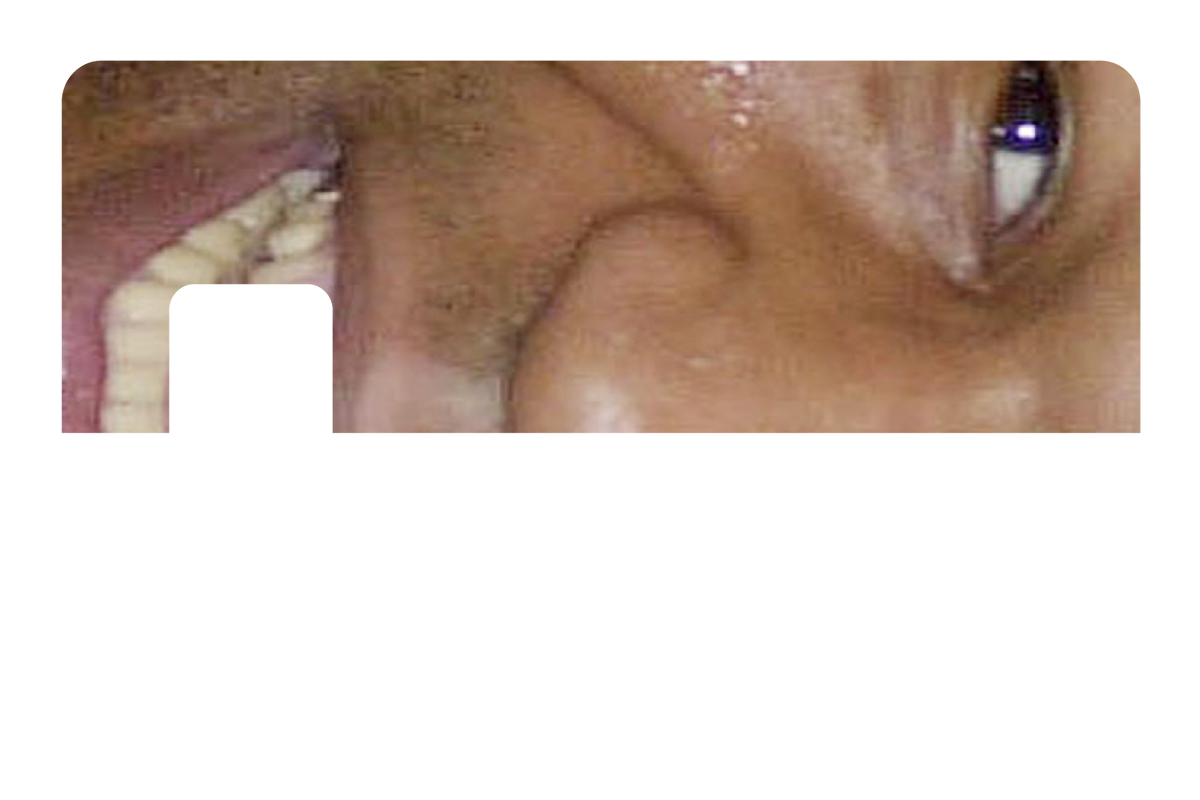 Tyson Grillz