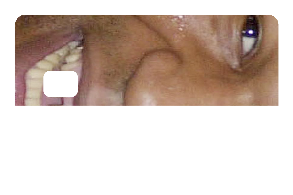 Tyson Grillz