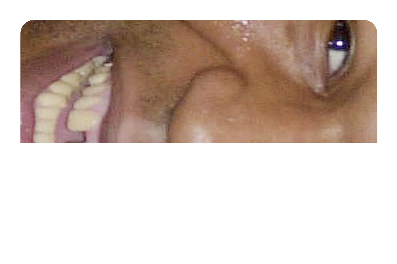 Tyson Grillz